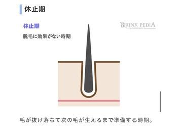 脱毛と毛周期の関係